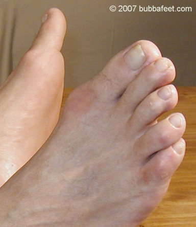 07061833