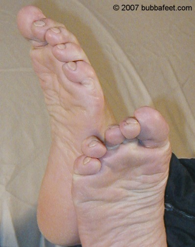 07061859